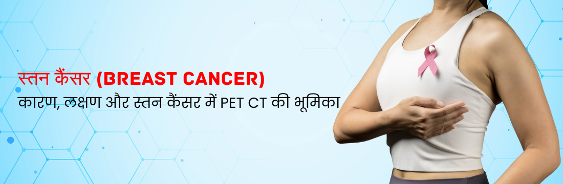 स्तन कैंसर: कारण, लक्षण और स्तन कैंसर में PET CT की भूमिका